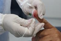 Município de Itajaí promove programação para a prevenção das hepatites virais